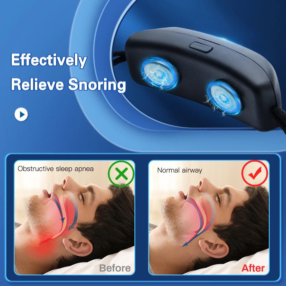 EMS Pulse Anti-Snoring Device – Portable Sleep Aid