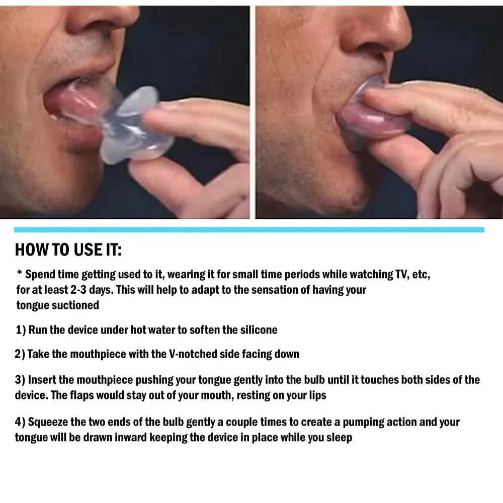 Anti-Snoring Silicone Tongue Retainer