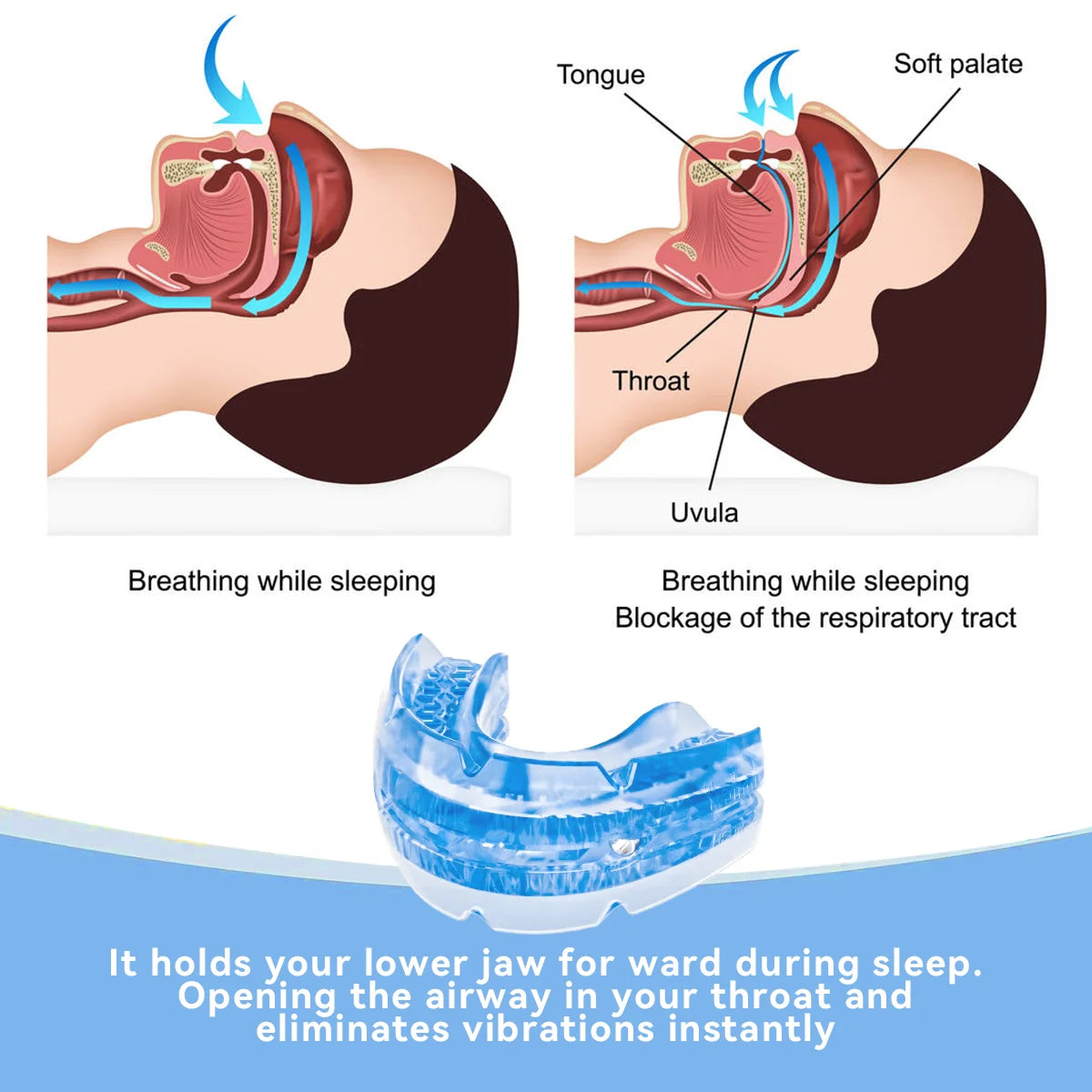 Adjustable Anti-Snoring Mouth Guard