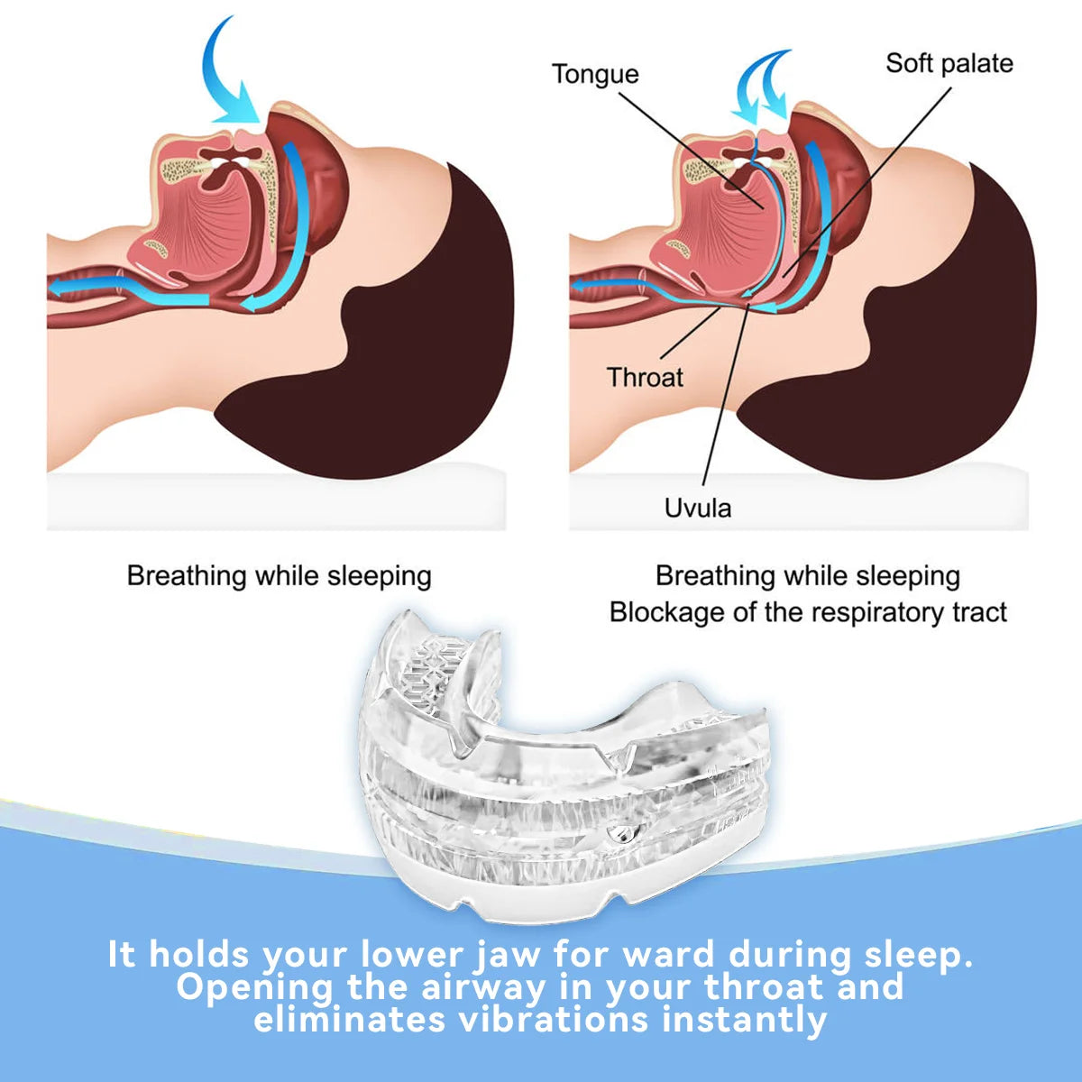 Adjustable Anti-Snoring Mouth Guard